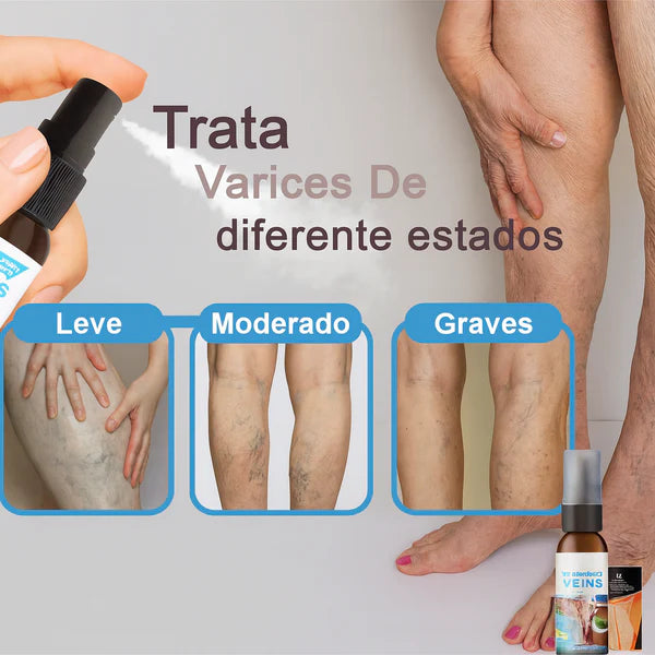 VariceFree Pro Kit Premium Spray + Parches